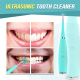 Sonic Pro Whitener™ - Portable Electric Dental Scaler